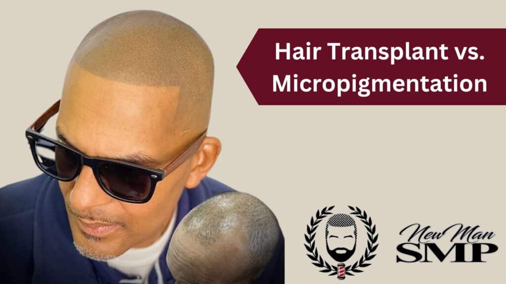 Hair Transplant vs. Micropigmentation: Which Is Better for You?