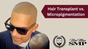 Hair Transplant vs. Micropigmentation: Which Is Better for You?
