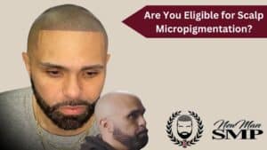 Are You Eligible for Scalp Micropigmentation?