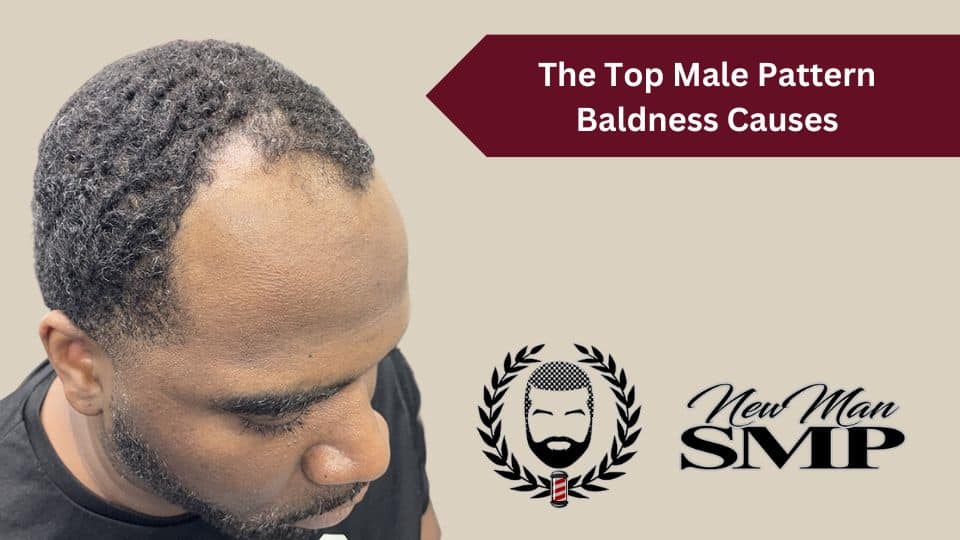 The Top Male Pattern Baldness Causes